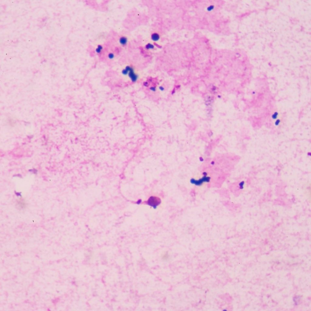 gametogenesis microscopic view of human sperm