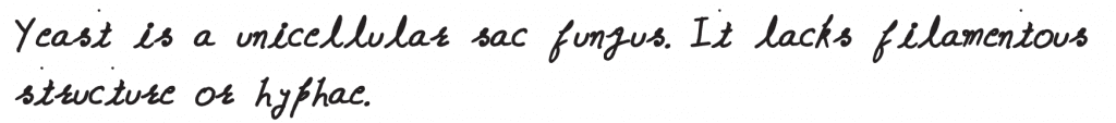 Which is of the following statements is incorrect